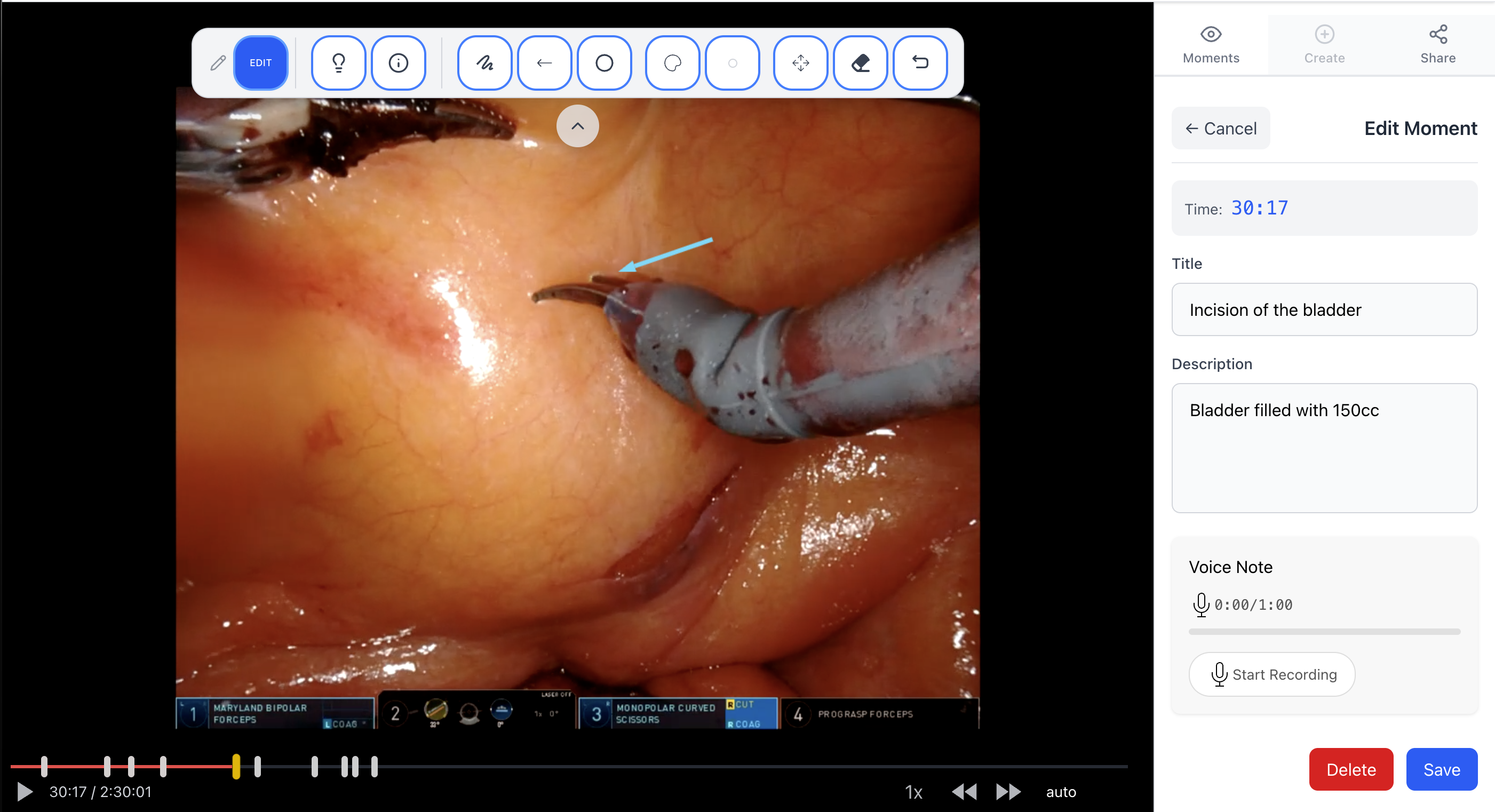 InOperis surgical video annotation interface