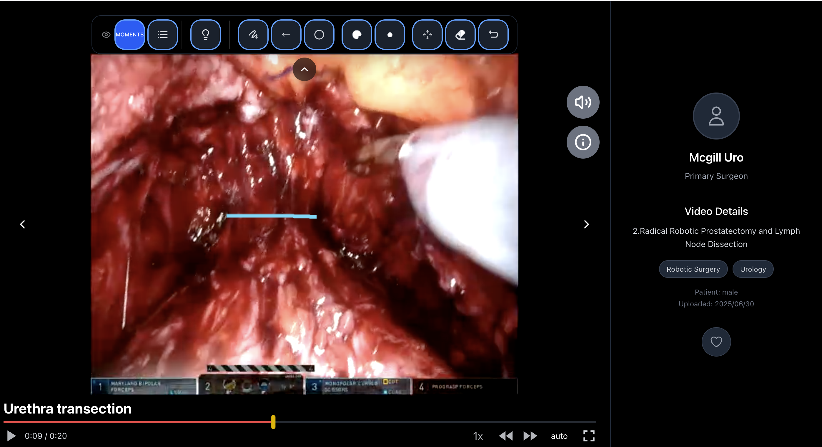 InOperis structured surgical case presentation view